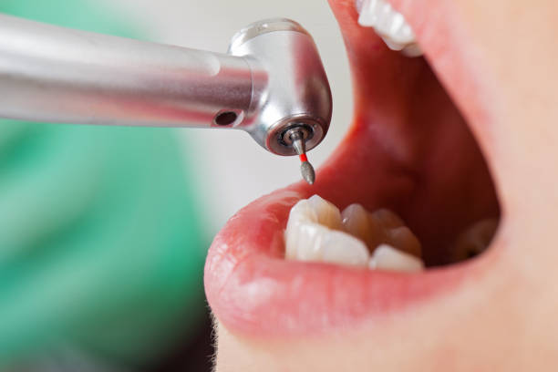 Best Root Canal Emergency Dentist  in Colfax, WI
